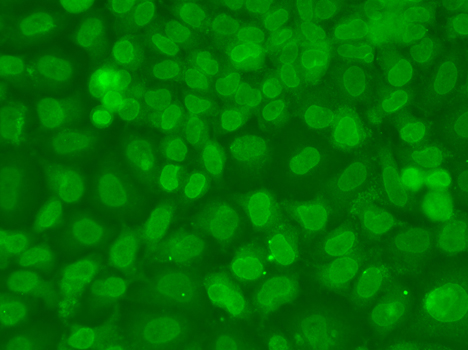 TARBP2 Rabbit polyclonal antibody