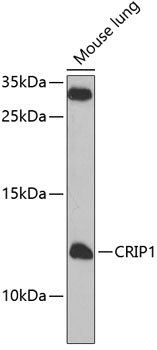CRIP1 Rabbit polyclonal antibody