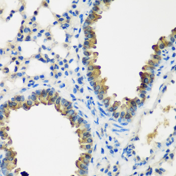 CYP2F1 Rabbit polyclonal antibody
