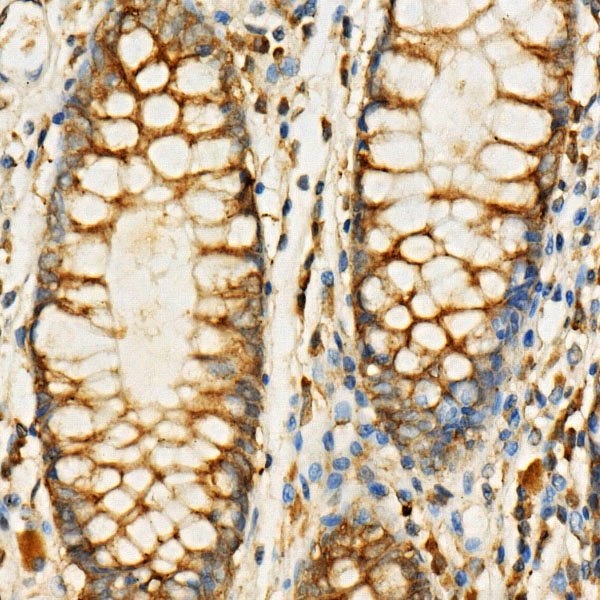 EIF4G1 Rabbit polyclonal antibody