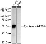 Western blot - Cytokeratin 6 (KRT6) Rabbit pAb (A7560)