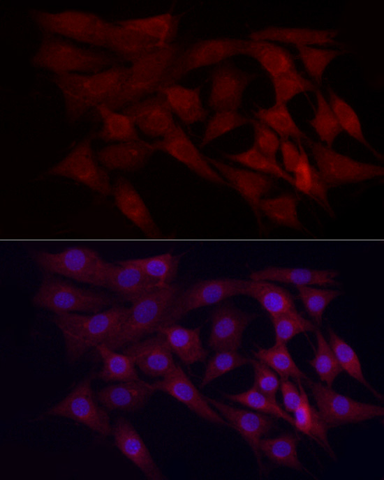 WDR45 Rabbit polyclonal antibody