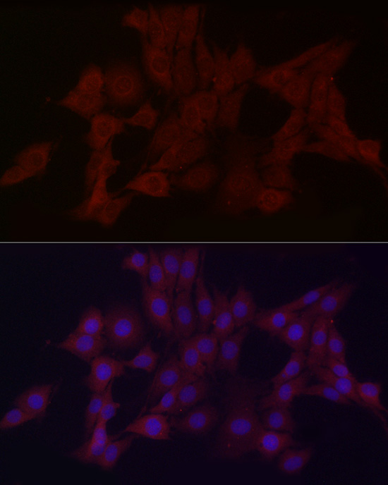 WDR45 Rabbit polyclonal antibody