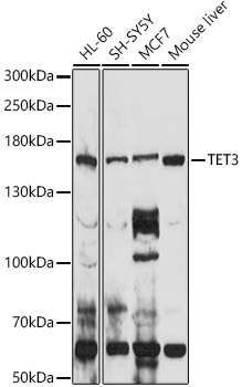 TET3 Rabbit polyclonal antibody