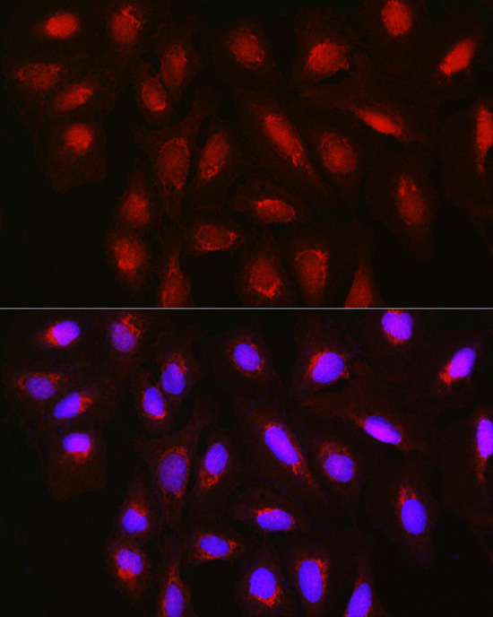 TET3 Rabbit polyclonal antibody