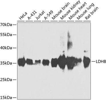 LDHB Rabbit polyclonal antibody