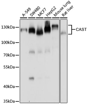 CAST Rabbit polyclonal antibody
