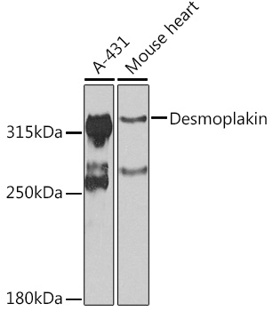 Desmoplakin Rabbit polyclonal antibody