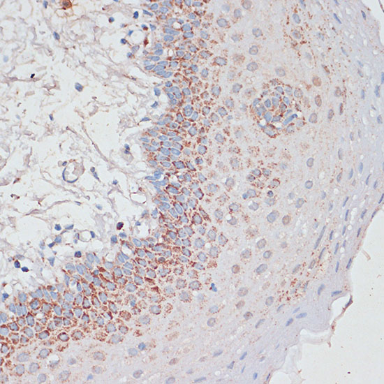 Desmoplakin Rabbit polyclonal antibody