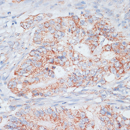 Desmoplakin Rabbit polyclonal antibody