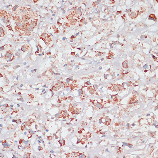 Desmoplakin Rabbit polyclonal antibody