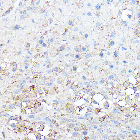 Notch1 Rabbit polyclonal antibody