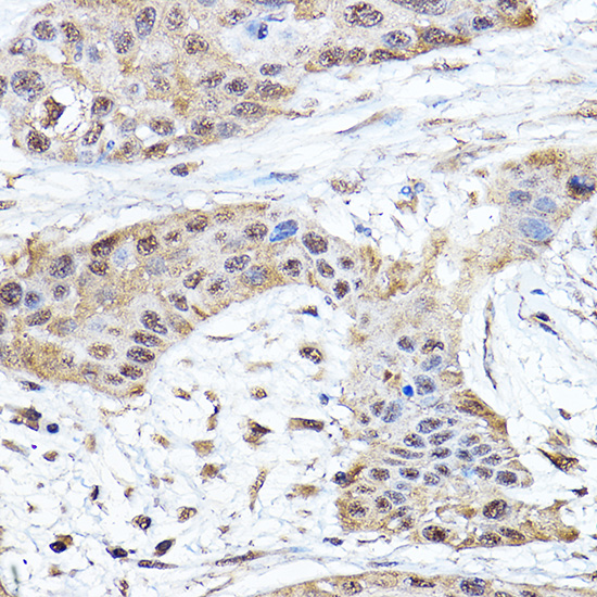 Notch1 Rabbit polyclonal antibody