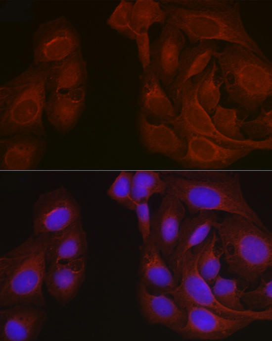 Notch1 Rabbit polyclonal antibody