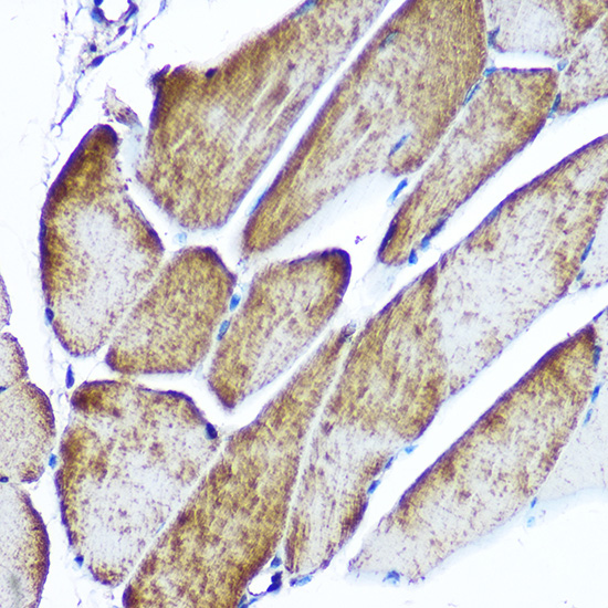 GLUT4 Rabbit polyclonal antibody