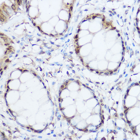 Thioredoxin 1 (Trx1/TXN) Rabbit polyclonal antibody
