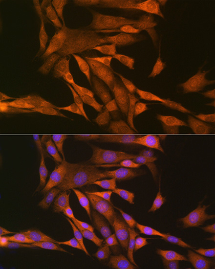 Thioredoxin 1 (Trx1/TXN) Rabbit polyclonal antibody