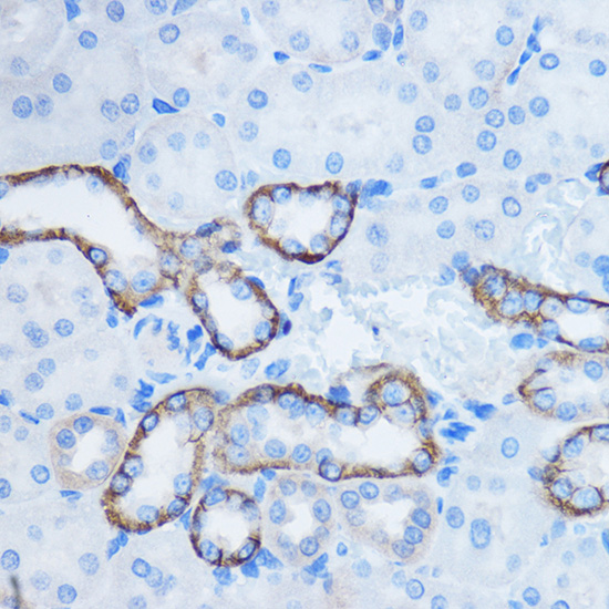 YWHAZ Rabbit polyclonal antibody