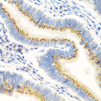 UBIAD1 Rabbit polyclonal antibody