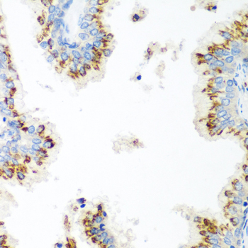 UBIAD1 Rabbit polyclonal antibody