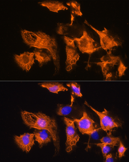 ARF4 Rabbit polyclonal antibody