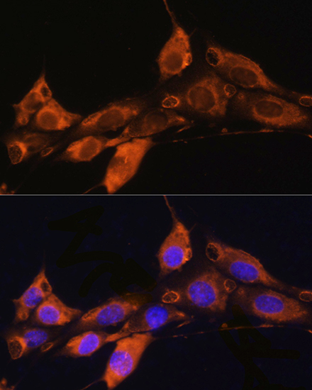 ARF4 Rabbit polyclonal antibody