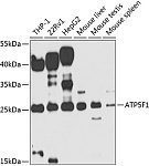 Western blot - ATP5F1 Rabbit pAb (A7645)