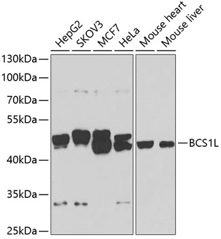 BCS1L Rabbit polyclonal antibody