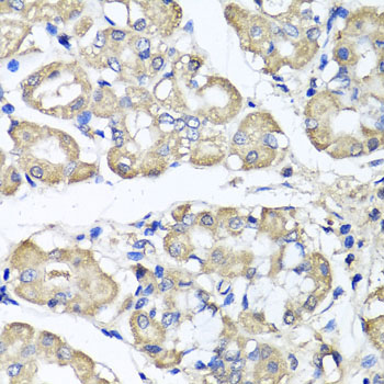 BCS1L Rabbit polyclonal antibody