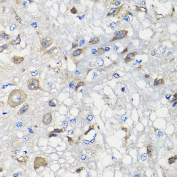 BCS1L Rabbit polyclonal antibody