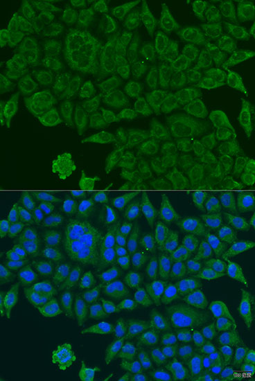 BCS1L Rabbit polyclonal antibody