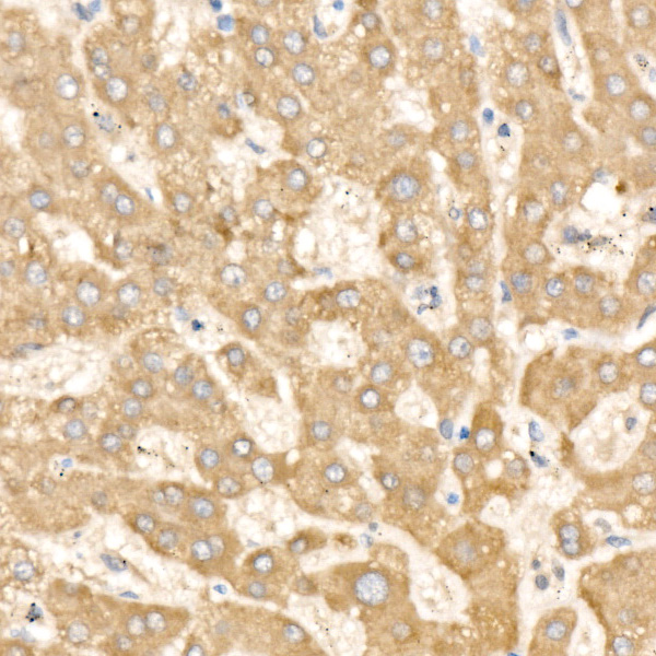 CHI3L2 Rabbit polyclonal antibody