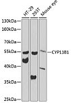 Western blot - CYP11B1 Rabbit pAb (A7664)
