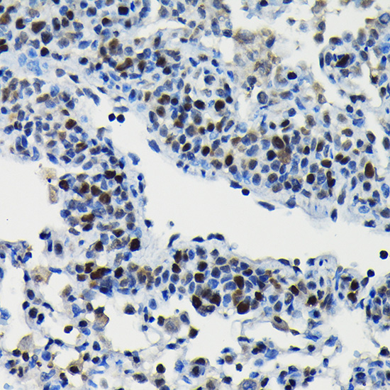 ARID3A Rabbit polyclonal antibody