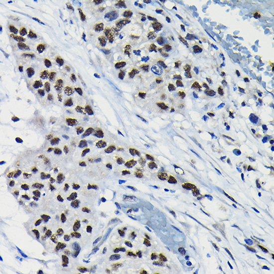 ARID3A Rabbit polyclonal antibody