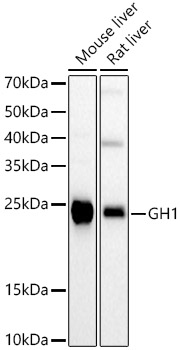 GH1 Rabbit polyclonal antibody
