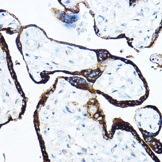 GH1 Rabbit polyclonal antibody