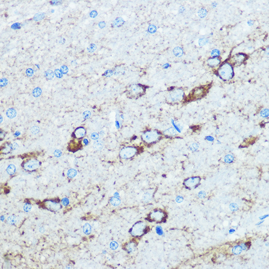NMDAR1 Rabbit polyclonal antibody