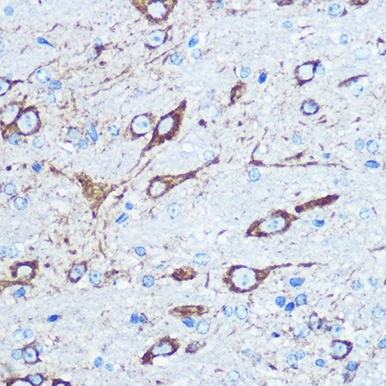 NMDAR1 Rabbit polyclonal antibody
