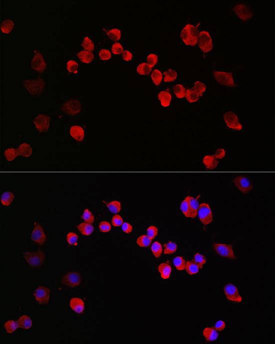 NMDAR1 Rabbit polyclonal antibody