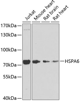 HSPA6 Rabbit polyclonal antibody