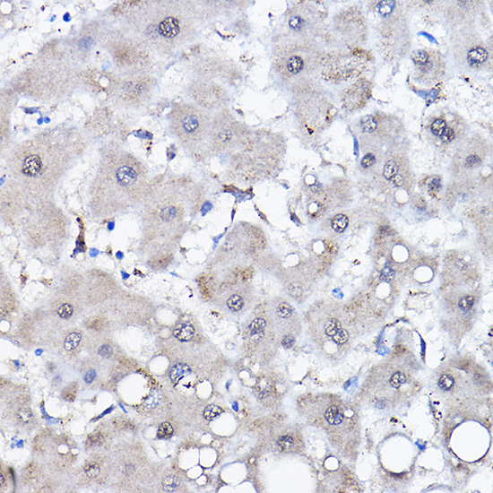 HSPA6 Rabbit polyclonal antibody