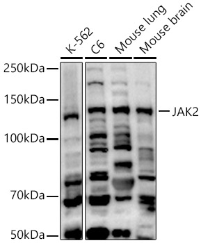 [KO Validated] JAK2 Rabbit polyclonal antibody
