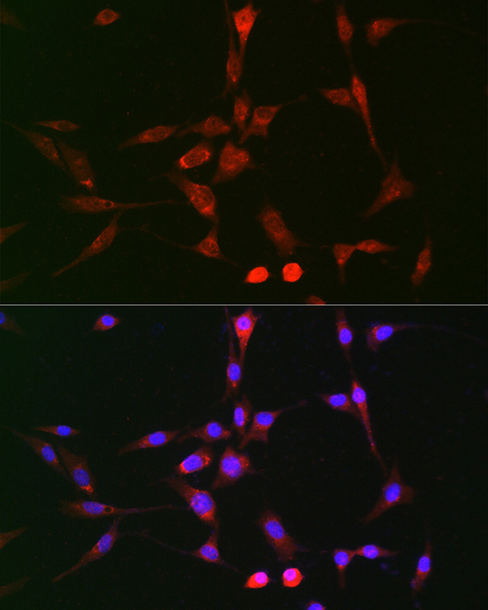 LOX Rabbit polyclonal antibody