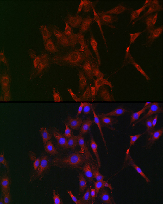 LOX Rabbit polyclonal antibody