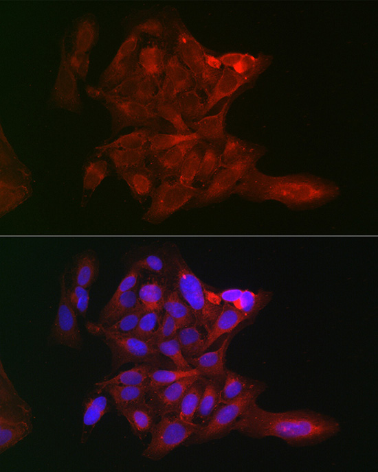 LOX Rabbit polyclonal antibody