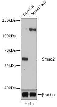 [KO Validated] Smad2 Rabbit polyclonal antibody