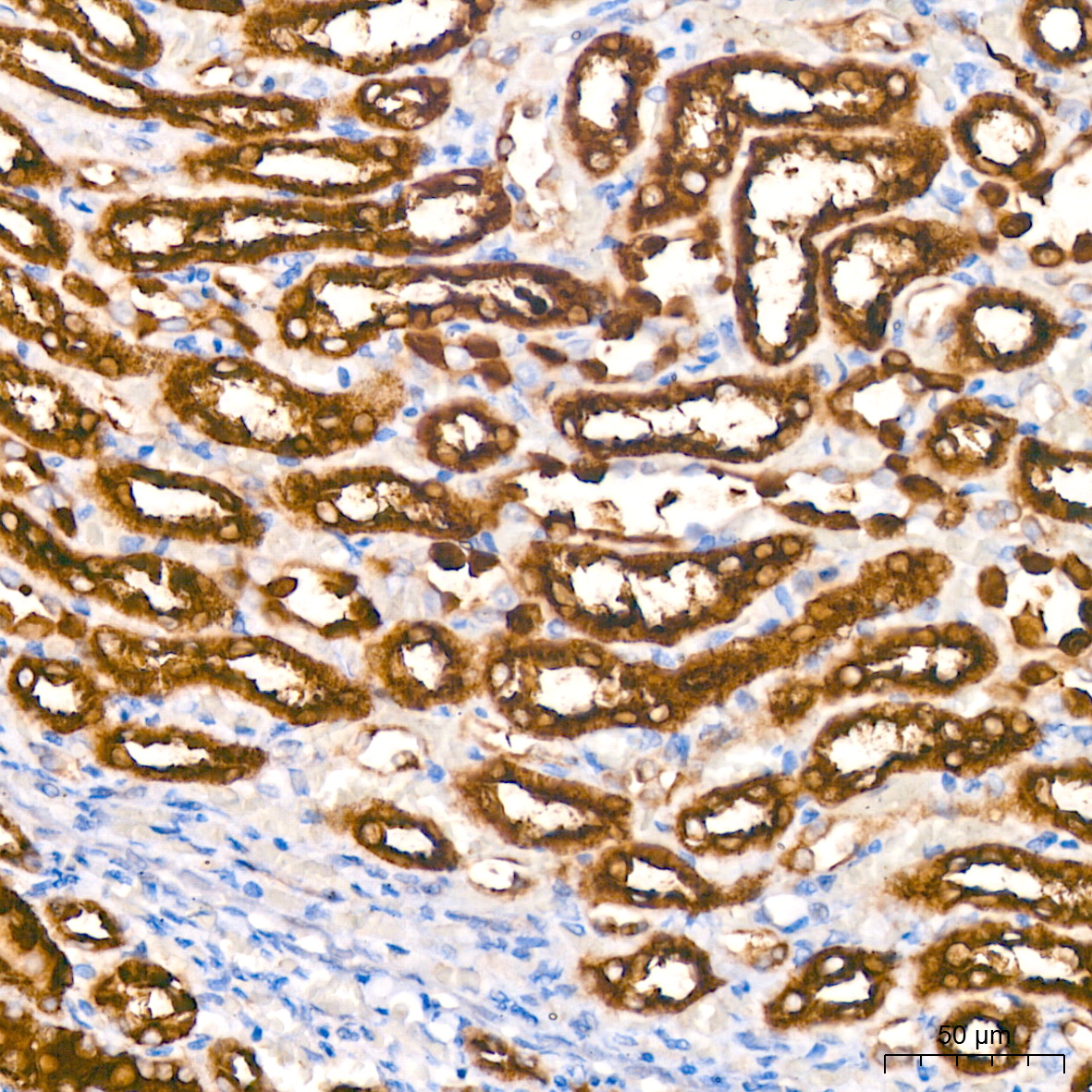 ALDH1L1 Rabbit monoclonal antibody