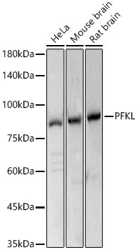 PFKL Rabbit polyclonal antibody