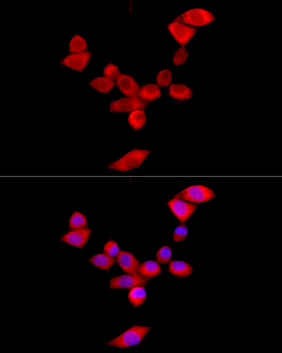 PFKL Rabbit polyclonal antibody